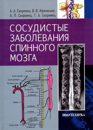 Сосудистые заболевания спинного мозга. Руководство для врачей