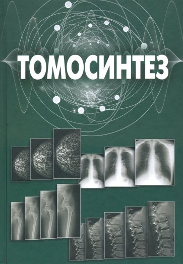 Томосинтез (монография)