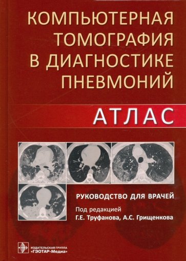 Компьютерная томография в диагностике пневмоний. Атлас