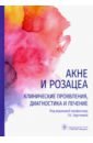 Акне и розацеа. Клинические проявления, диагностика и лечение