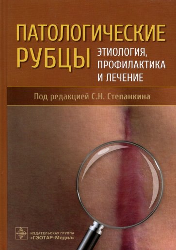 Патологические рубцы. Этиология, профилактика и лечение