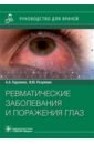 Ревматические заболевания и поражения глаз. Руководство для врачей