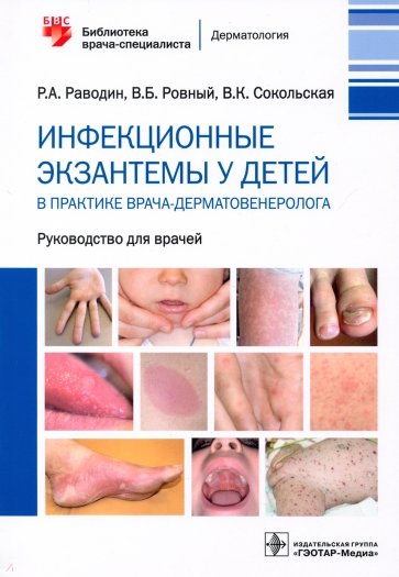 Инфекционные экзантемы у детей в практике врача-дерматовенеролога. Руководство