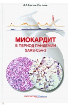Миокардит в период пандемии SARS-CoV-2 Практическая медицина