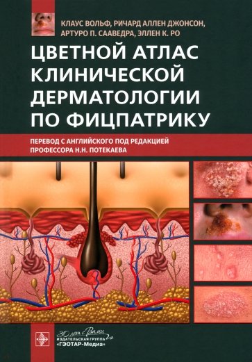 Цветной атлас клинической дерматологии по Фицпатрику