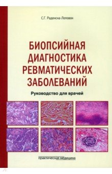 Биопсийная диагностика ревматических заболеваний. Руководство для врачей Практическая медицина