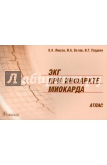 ЭКГ при инфаркте миокарда: атлас - Люсов, Волов, Гордеев