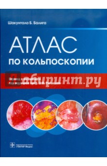 Шакунтала Балига - Атлас по кольпоскопии обложка книги Шакунтала Балига - Атлас по кольпоскопии обложка книги