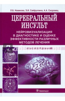 Новикова, Скоромец, Сайфуллина - Церебральный инсульт. Атлас исследований обложка книги Новикова, Скоромец, Сайфуллина - Церебральный инсульт. Атлас исследований обложка книги