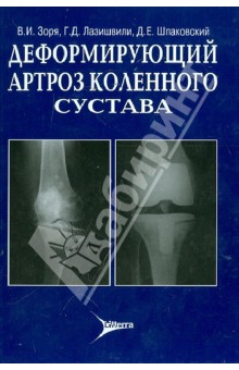 Деформирующий артроз коленного сустава: руководство - Зоря, Лазишвили, Шпаковский
