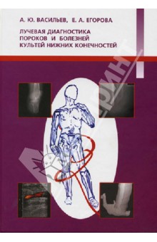Васильев, Егорова - Лучевая диагностика пороков и болезней культей нижних конечностей обложка книги Васильев, Егорова - Лучевая диагностика пороков и болезней культей нижних конечностей обложка книги