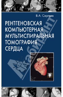 Рентгеновская компьютерная мультиспиральная томография сердца - В. Сергеев