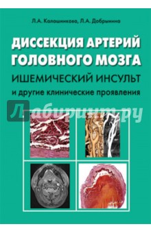 Калашникова, Добрынина - Диссекция артерий головного мозга: ишемический инсульт и другие клинические проявления обложка книги Калашникова, Добрынина - Диссекция артерий головного мозга: ишемический инсульт и другие клинические проявления обложка книги