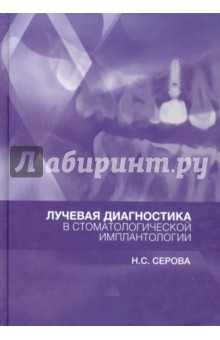 Лучевая диагностика в стоматологической имплантологии. Атлас - Наталья Серова