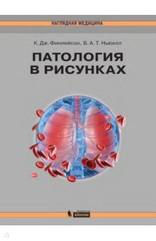 Патология в рисунках - Финлейсон, Ньюелл