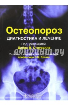 Остеопороз. Диагностика и лечение - Адлер, Байскобинг, Болоньезе