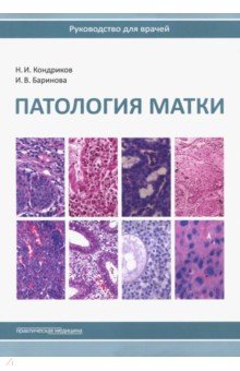 Патология матки.Руководство для врачей.2изд обложка книги Патология матки.Руководство для врачей.2изд обложка книги