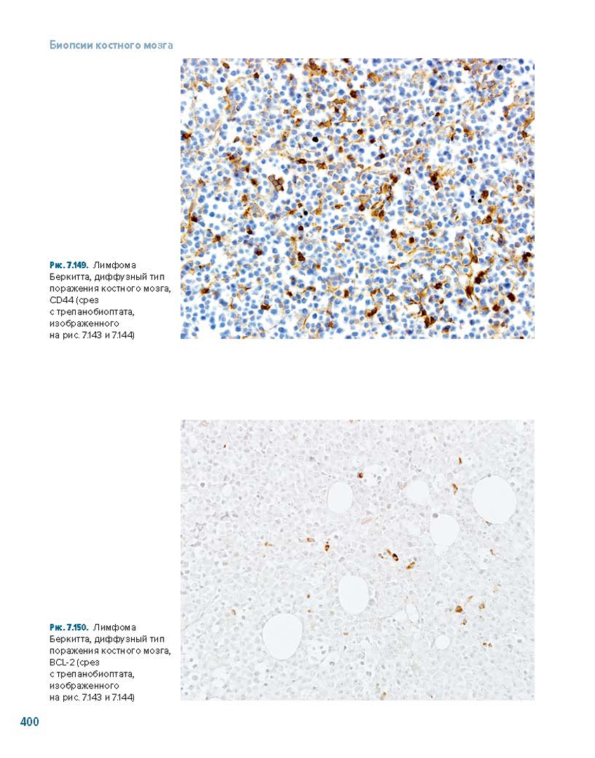 Иллюстрация 11 из 18 для Биопсии костного мозга + DVD - Юрий Криволапов | Лабиринт - книги. Источник: Лабиринт