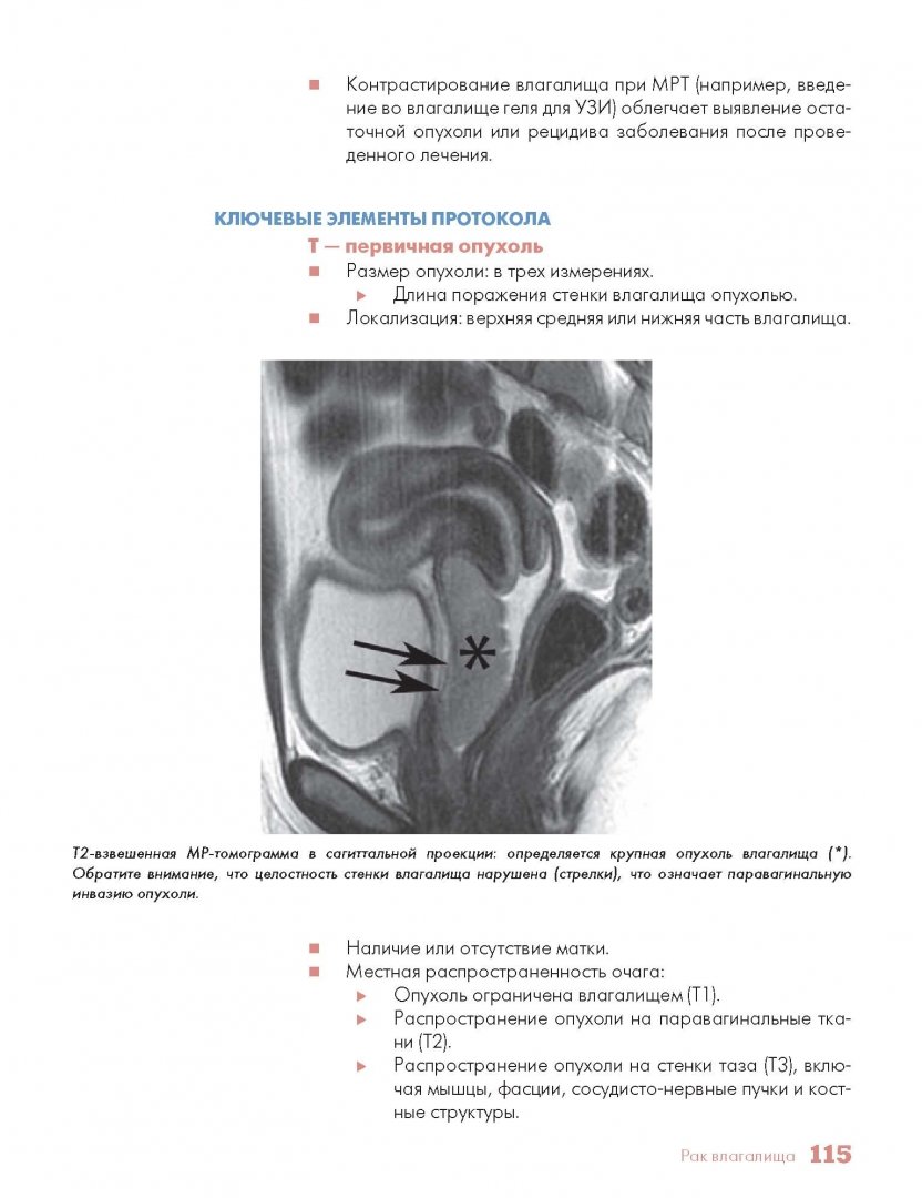 Иллюстрация 2 из 21 для Методы визуализации в онкологии. Стандарты описания опухолей. Цветной атлас - Хричак, Хасбанд, Паничек | Лабиринт - книги. Источник: Лабиринт