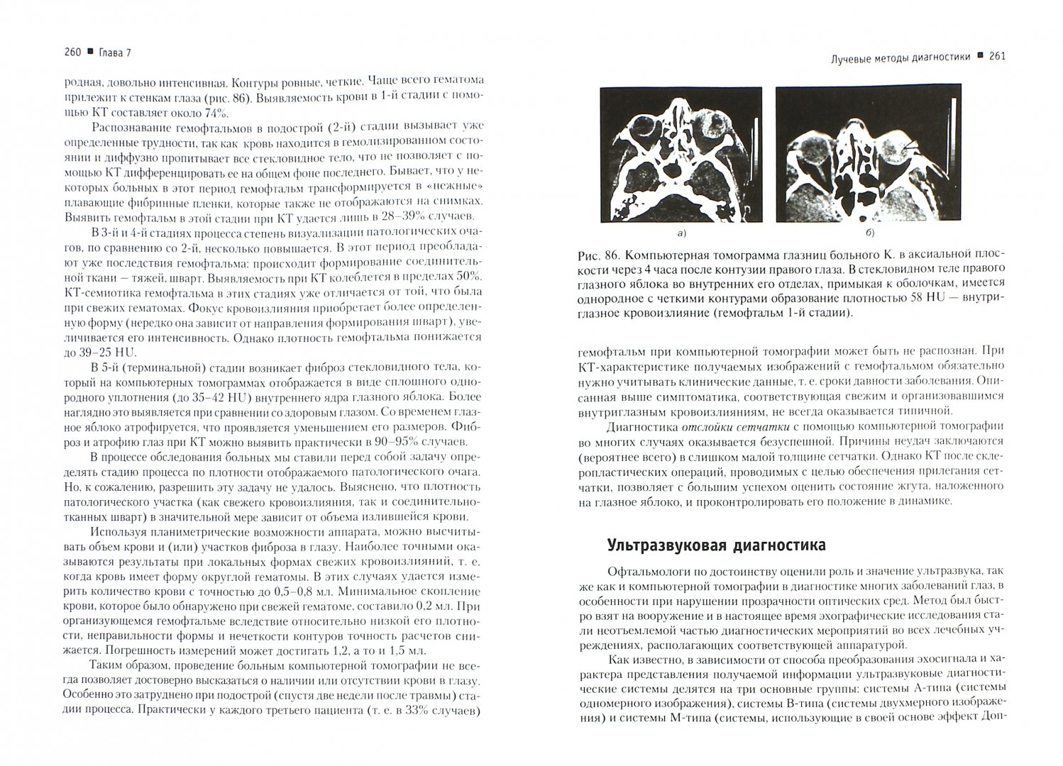 Иллюстрация 1 из 11 для Современная офтальмология: Руководство. 2-е изд. | Лабиринт - книги. Источник: Лабиринт