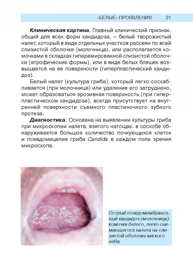 Иллюстрация 10 из 19 для Заболевания слизистой оболочки рта и губ - Арутюнов, Цветкова-Аксамит, Петрова | Лабиринт - книги. Источник: Лабиринт