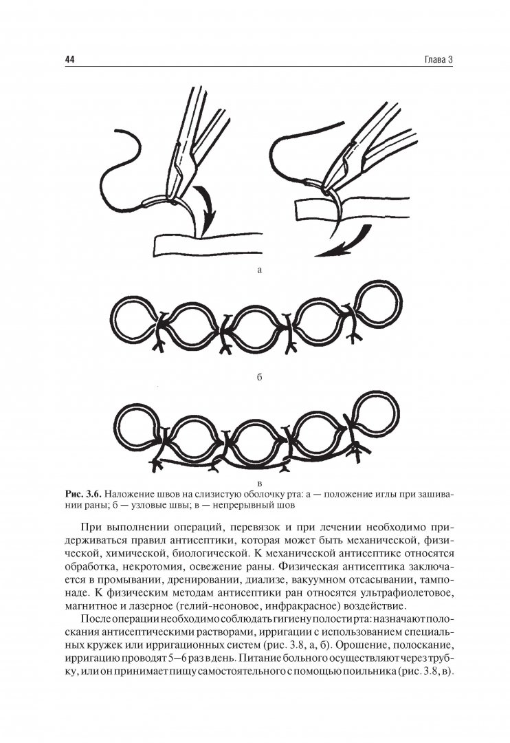 Иллюстрация 13 из 27 для Челюстно-лицевая хирургия. Учебник - Дробышев, Бельченко, Байриков | Лабиринт - книги. Источник: Лабиринт
