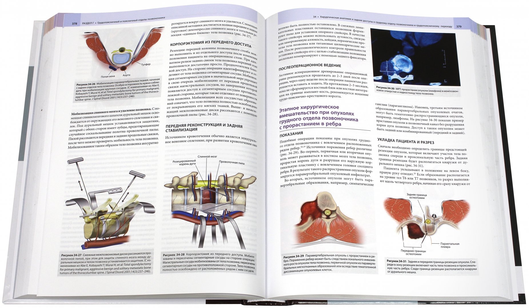 Иллюстрация 1 из 7 для Позвоночник. Хирургическая анатомия и оперативная техника - Ким, Ваккаро, Дикман, Чо | Лабиринт - книги. Источник: Лабиринт
