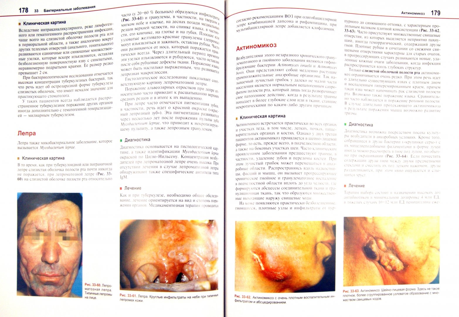 Иллюстрация 1 из 6 для Болезни слизистой оболочки полости рта и губ. Клиника, диагностика и лечение - Борк, Бургдорф, Хеде | Лабиринт - книги. Источник: Лабиринт