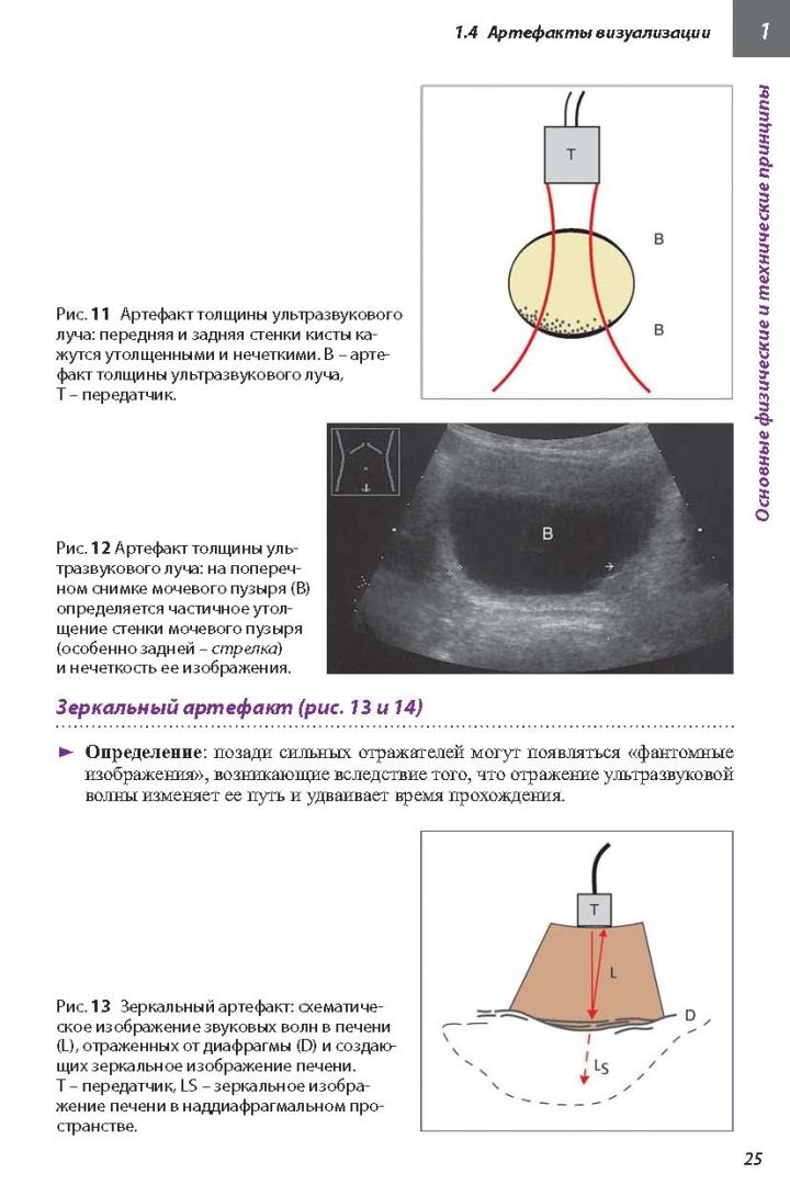 Иллюстрация 6 из 16 для Ультразвуковая диагностика. Практическое руководство - Гюнтер Шмидт | Лабиринт - книги. Источник: Лабиринт