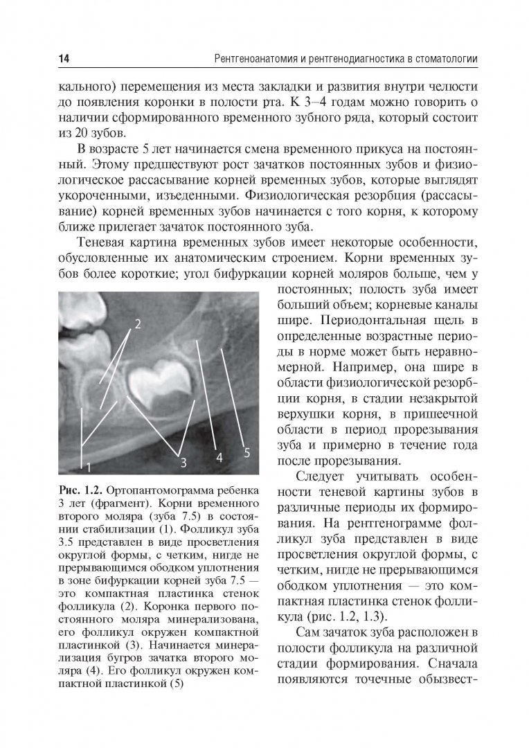 Иллюстрация 6 из 24 для Рентгеноанатомия и рентгенодиагностика в стоматологии - Виктор Трутень | Лабиринт - книги. Источник: Лабиринт