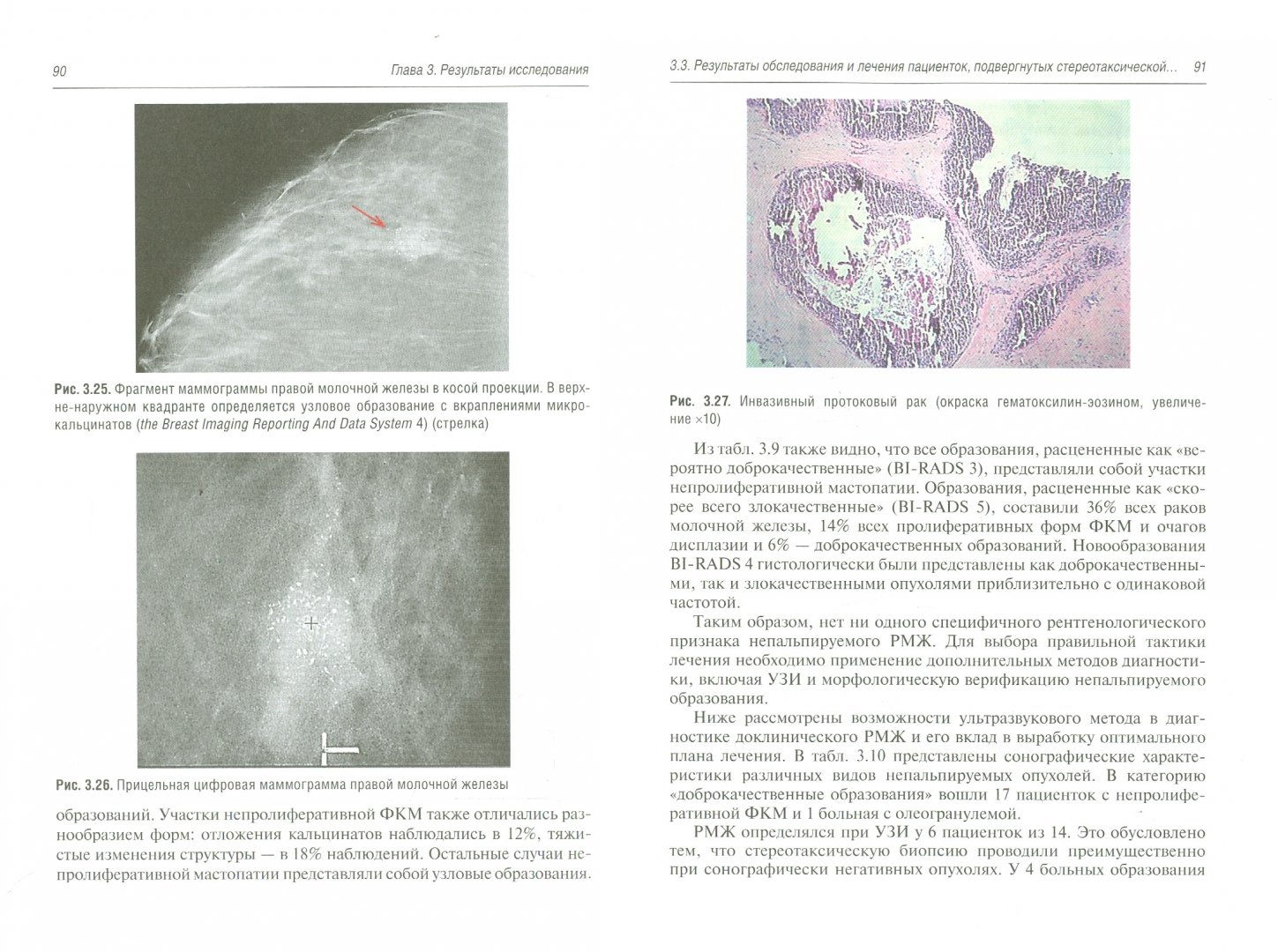 Иллюстрация 1 из 5 для Непальпируемые опухоли молочных желез - Куликов, Загалаев | Лабиринт - книги. Источник: Лабиринт