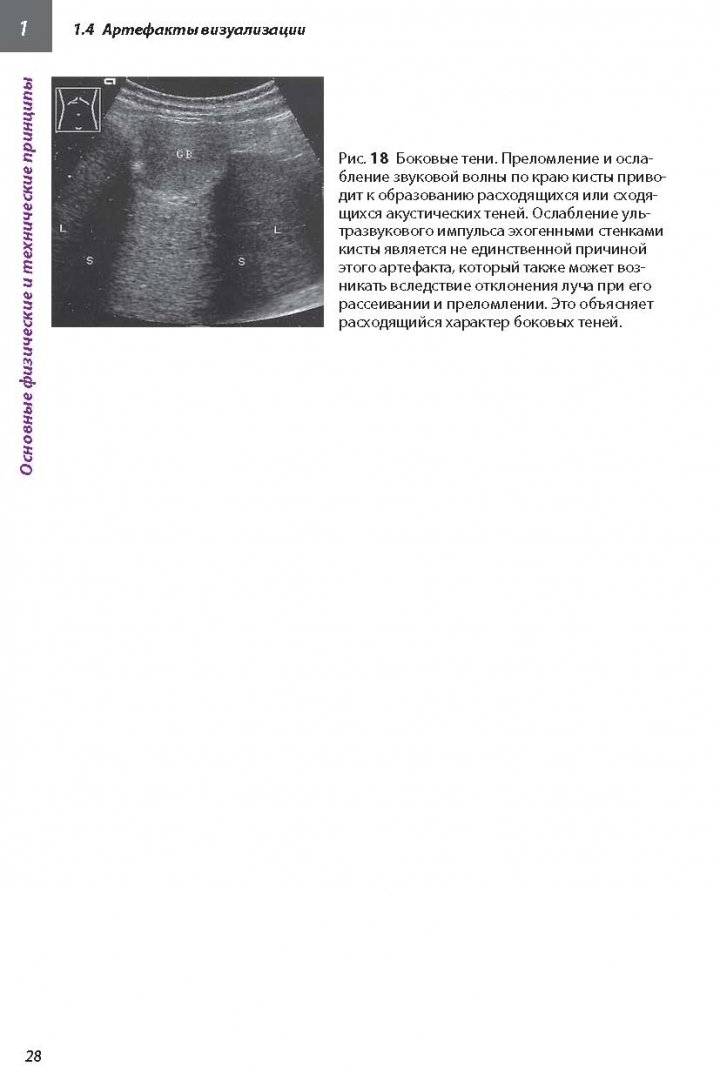 Иллюстрация 10 из 16 для Ультразвуковая диагностика. Практическое руководство - Гюнтер Шмидт | Лабиринт - книги. Источник: Лабиринт