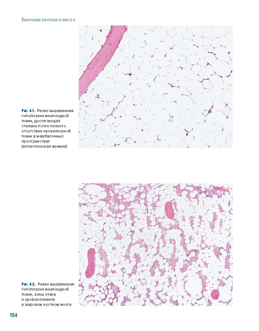 Иллюстрация 4 из 18 для Биопсии костного мозга + DVD - Юрий Криволапов | Лабиринт - книги. Источник: Лабиринт