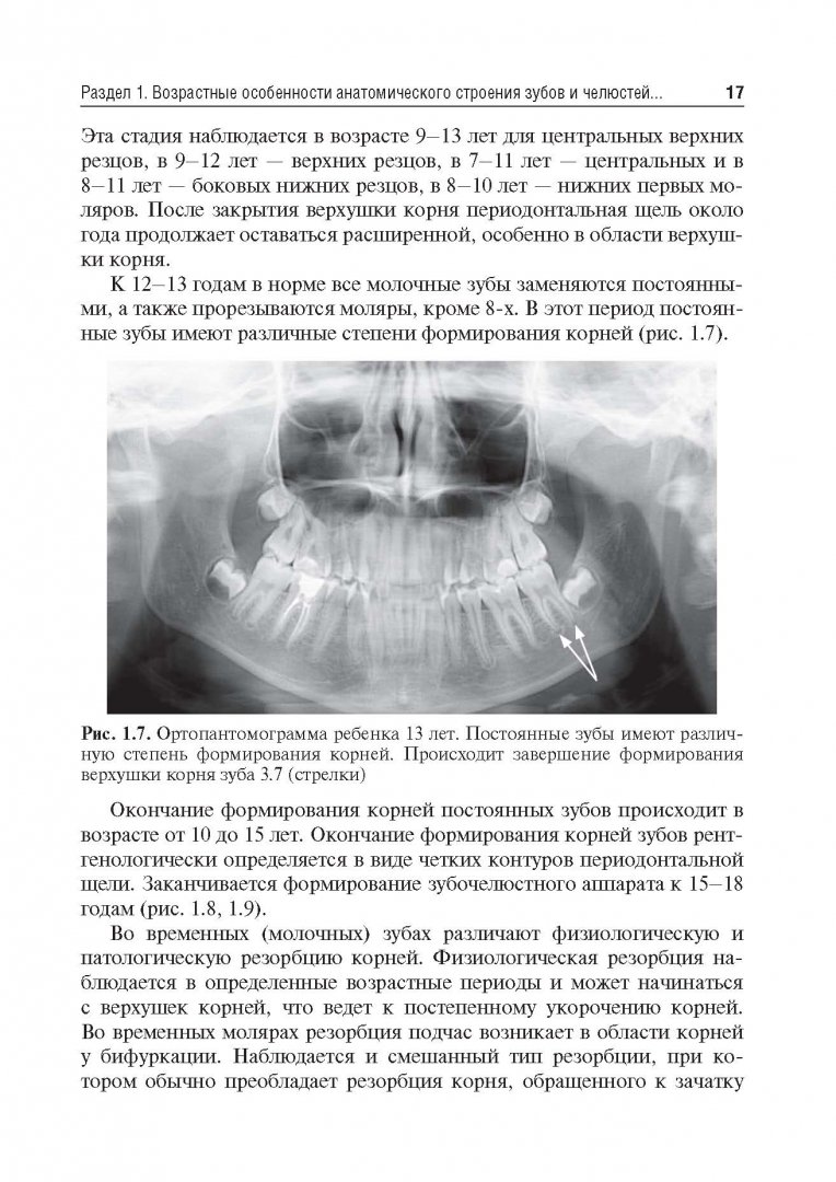 Иллюстрация 9 из 24 для Рентгеноанатомия и рентгенодиагностика в стоматологии - Виктор Трутень | Лабиринт - книги. Источник: Лабиринт