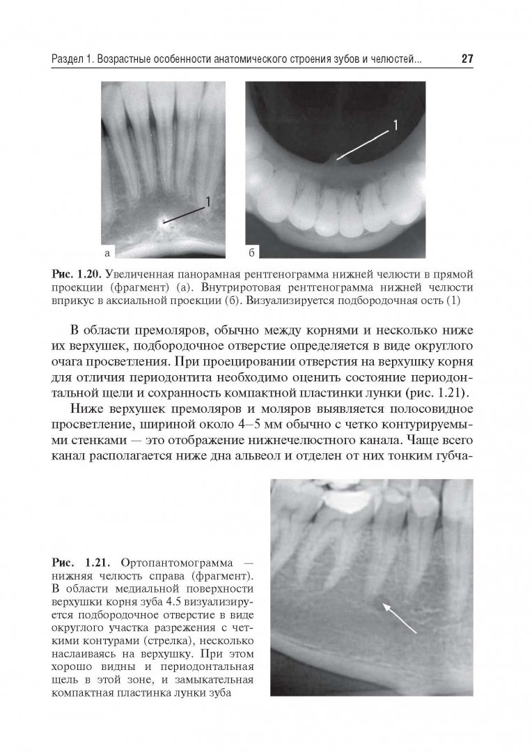 Иллюстрация 16 из 24 для Рентгеноанатомия и рентгенодиагностика в стоматологии - Виктор Трутень | Лабиринт - книги. Источник: Лабиринт