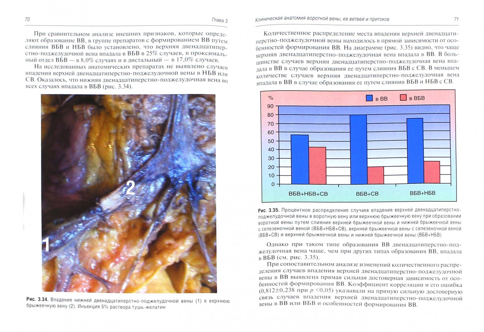 Иллюстрация 1 из 4 для Клиническая анатомия системы воротной вены печени - Калинин, Виноградов, Андреева | Лабиринт - книги. Источник: Лабиринт