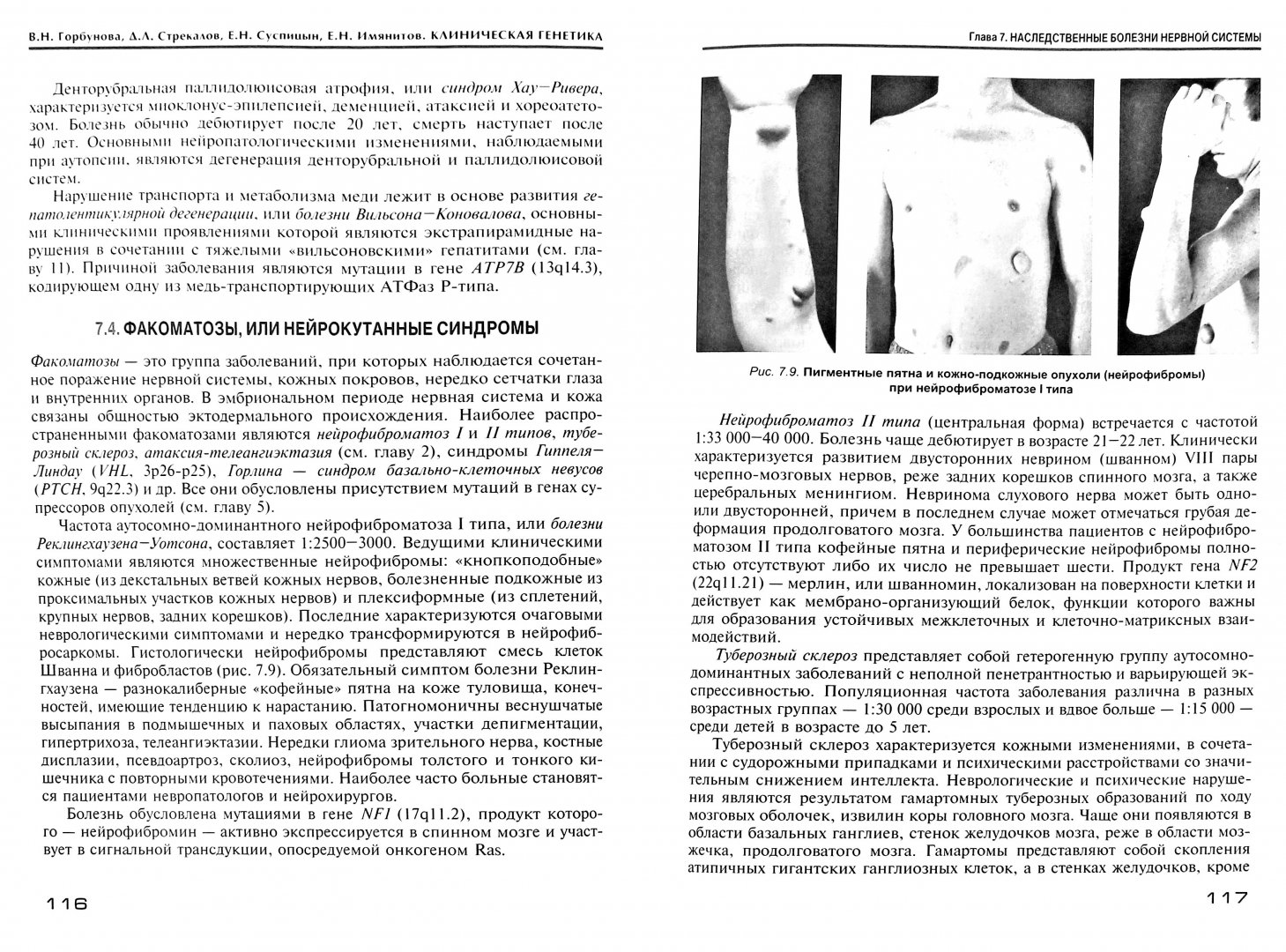 Иллюстрация 1 из 14 для Клиническая генетика. Учебник - Горбунова, Стрекалов, Суспицын, Имянитов | Лабиринт - книги. Источник: Лабиринт