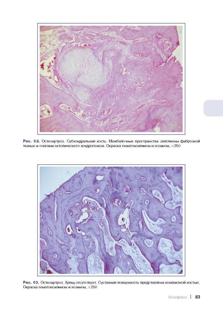 Иллюстрация 6 из 13 для Ревматические заболевания. Морфологическая диагностика. Руководство для врачей - Стефка Раденска-Лоповок | Лабиринт - книги. Источник: Лабиринт