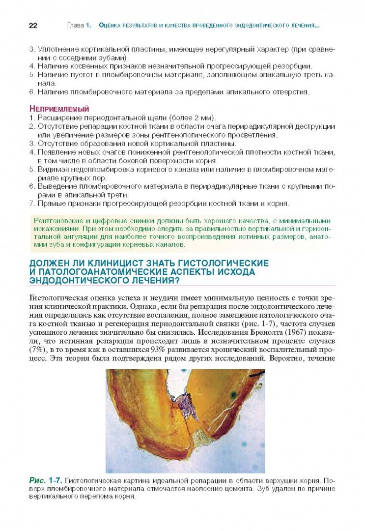 Иллюстрация 12 из 26 для Решение проблем в эндодонтии. Профилактика, диагностика и лечение - Гуиман, Думша, Ловдэл | Лабиринт - книги. Источник: Лабиринт