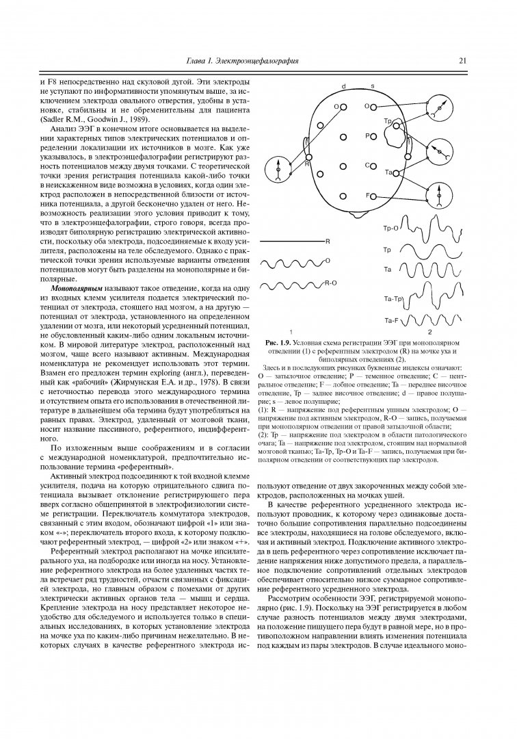 Иллюстрация 10 из 22 для Функциональная диагностика нервных болезней - Зенков, Ронкин | Лабиринт - книги. Источник: Лабиринт