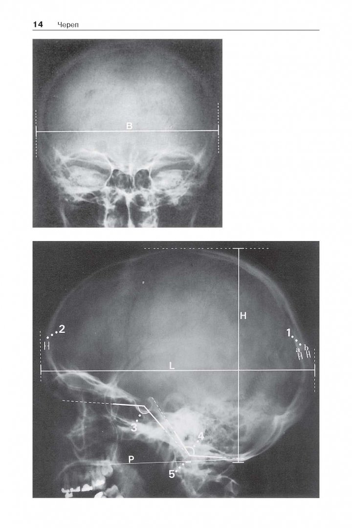 Иллюстрация 5 из 30 для Норма при рентгенологических исследованиях - Торстен Меллер | Лабиринт - книги. Источник: Лабиринт