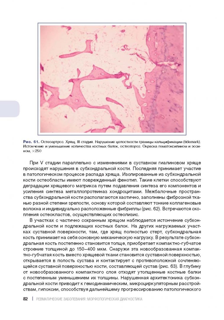 Иллюстрация 5 из 13 для Ревматические заболевания. Морфологическая диагностика. Руководство для врачей - Стефка Раденска-Лоповок | Лабиринт - книги. Источник: Лабиринт