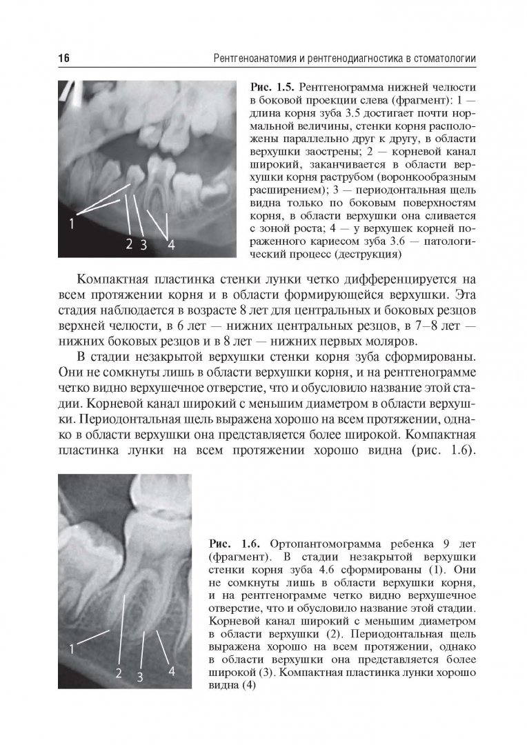 Иллюстрация 8 из 24 для Рентгеноанатомия и рентгенодиагностика в стоматологии - Виктор Трутень | Лабиринт - книги. Источник: Лабиринт