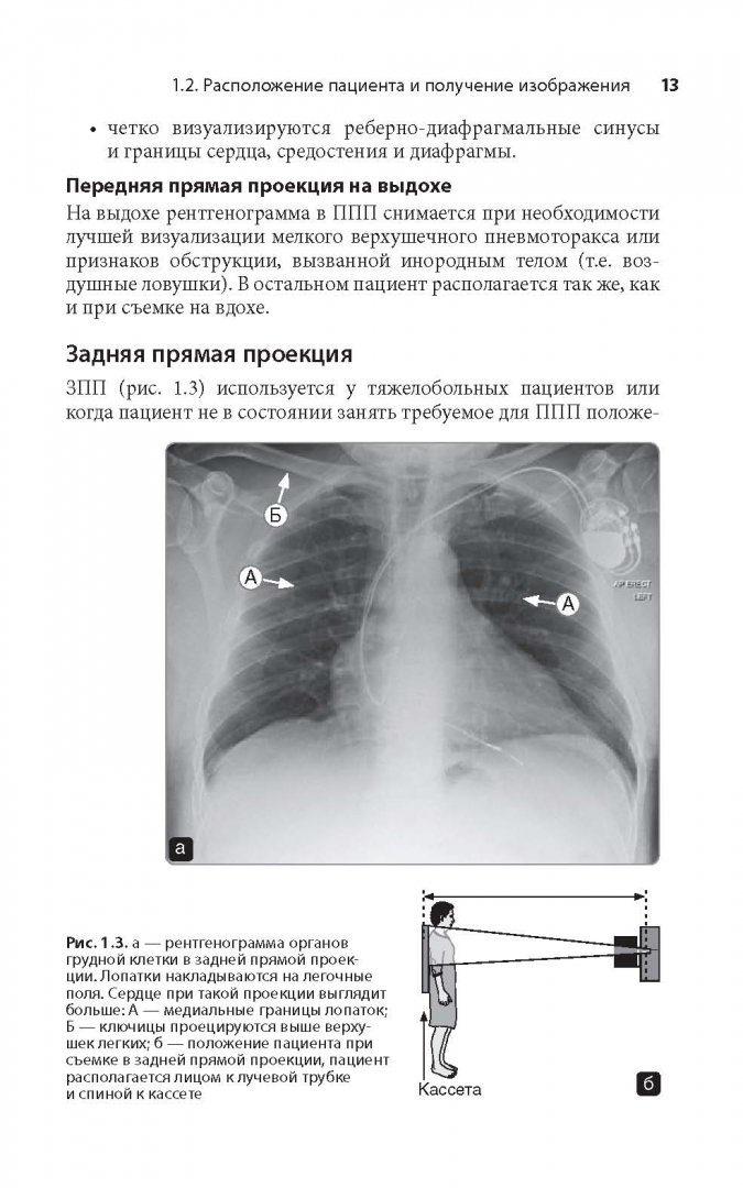 Иллюстрация 5 из 22 для Клиническая интерпретация рентгенограммы легких - Дарби, Эди, Чендрейтриа | Лабиринт - книги. Источник: Лабиринт