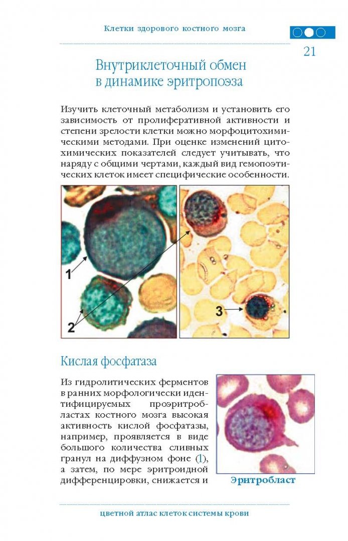 Иллюстрация 9 из 16 для Цветной атлас клеток системы крови - Погорелов, Проценко, Козинец | Лабиринт - книги. Источник: Лабиринт