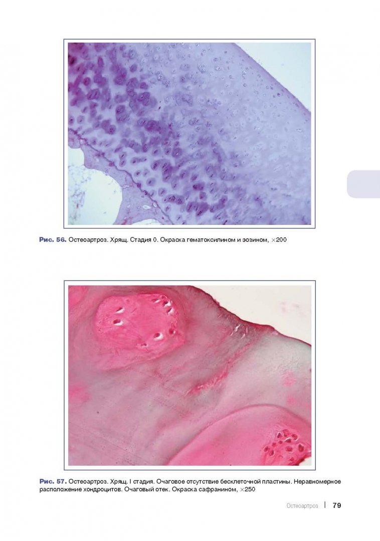 Иллюстрация 2 из 13 для Ревматические заболевания. Морфологическая диагностика. Руководство для врачей - Стефка Раденска-Лоповок | Лабиринт - книги. Источник: Лабиринт