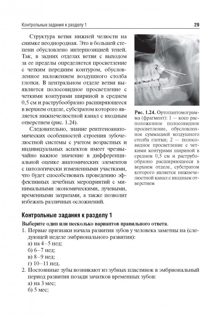 Иллюстрация 18 из 24 для Рентгеноанатомия и рентгенодиагностика в стоматологии - Виктор Трутень | Лабиринт - книги. Источник: Лабиринт