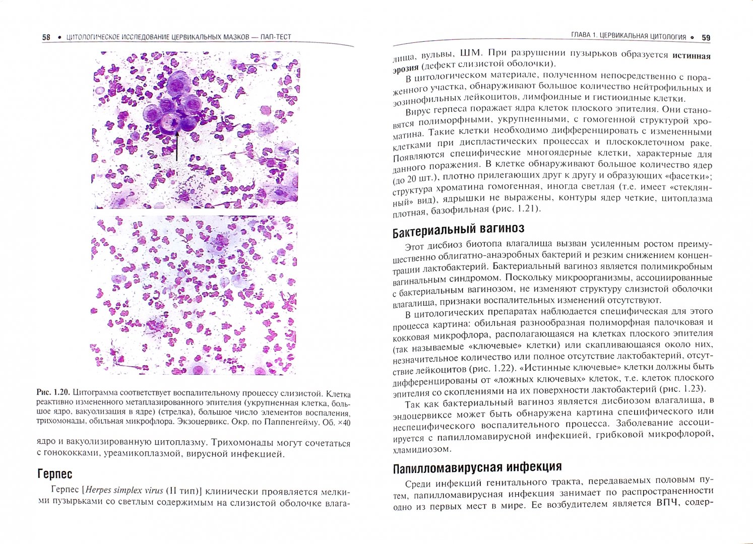Иллюстрация 1 из 11 для Цитологическое исследование цервикальных мазков. Пап-тест - Полонская, Юрасова | Лабиринт - книги. Источник: Лабиринт