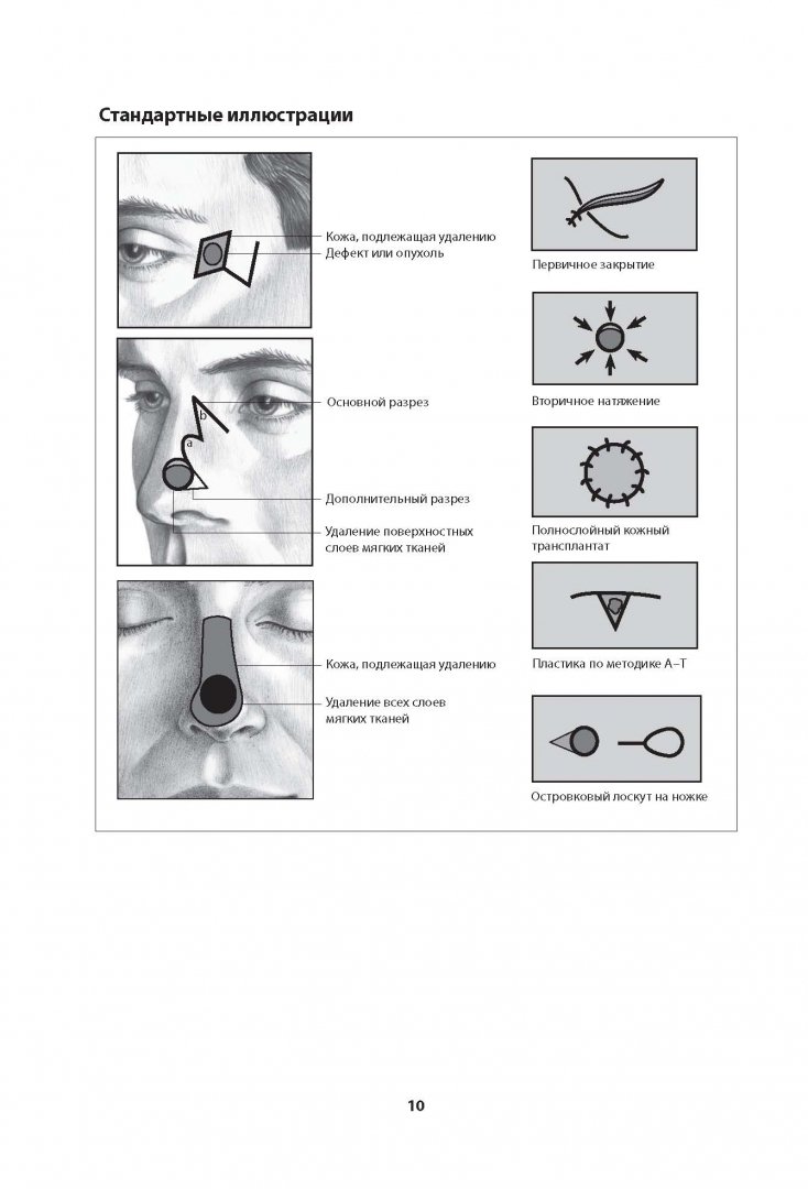 Иллюстрация 12 из 15 для Реконструктивная пластическая хирургия лица. Дифференцированный подход - Шеррис, Ларраби | Лабиринт - книги. Источник: Лабиринт