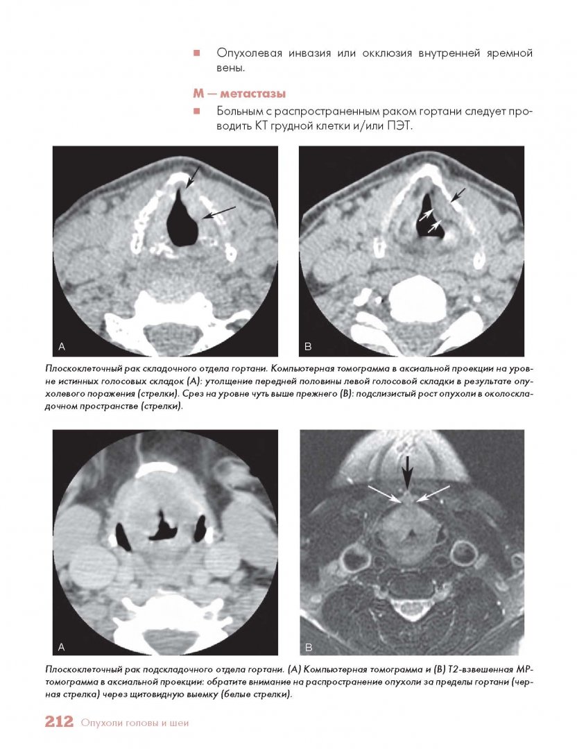Иллюстрация 8 из 21 для Методы визуализации в онкологии. Стандарты описания опухолей. Цветной атлас - Хричак, Хасбанд, Паничек | Лабиринт - книги. Источник: Лабиринт
